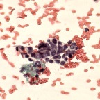 pap5